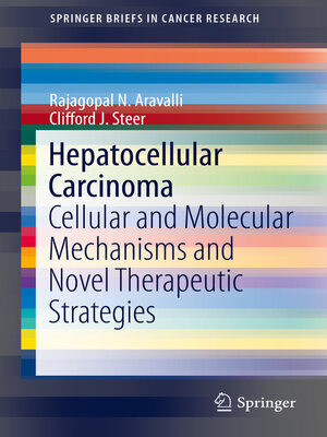 cover image of Hepatocellular Carcinoma
